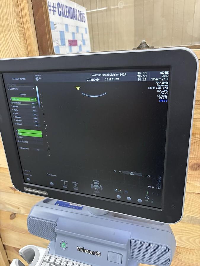 Used GE Voluson P8, 1 Probe 4C 3D/4D Ultrasound
