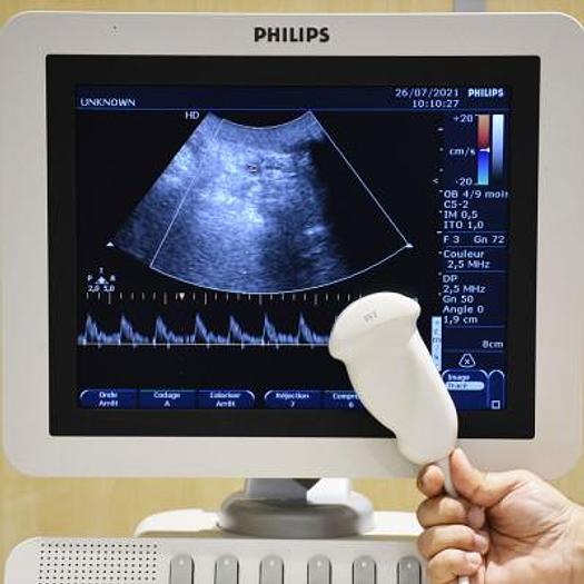 D'occasion Echographe PHILIPS HD7 (générale et gynécologique)