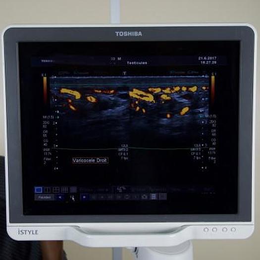 Used ECHOGRAPHE DOPPLER COULEUR TOSHIBA XARIO ISTYLE