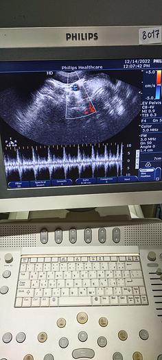 Gebraucht Philips C8-4V Transvaginal Ultraschallsonde