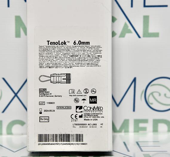 TENOLOK 6.0MM T60S TENODESIS ANCHOR WITH ONE #2 HI-FI SUTURE, IN-DATE, NEW