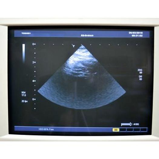 Used TOSHIBA APLIO 80 XARIO AVEC 4 SONDES