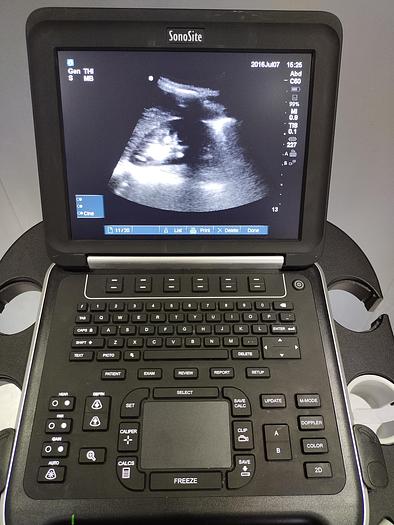 Gebraucht Sonosite Edge Ultraschallgerät inkl. 2 Sonden und Sony UP-D897 Drucker