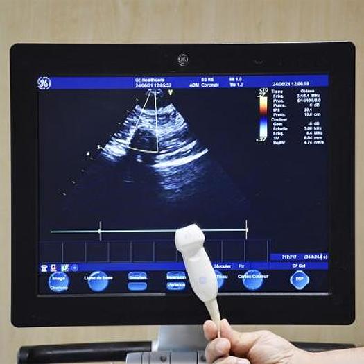 D'occasion ECHOCARDIOGRAPHE GENERAL ELECTRIC VIVID S6 AVEC 4 SONDES