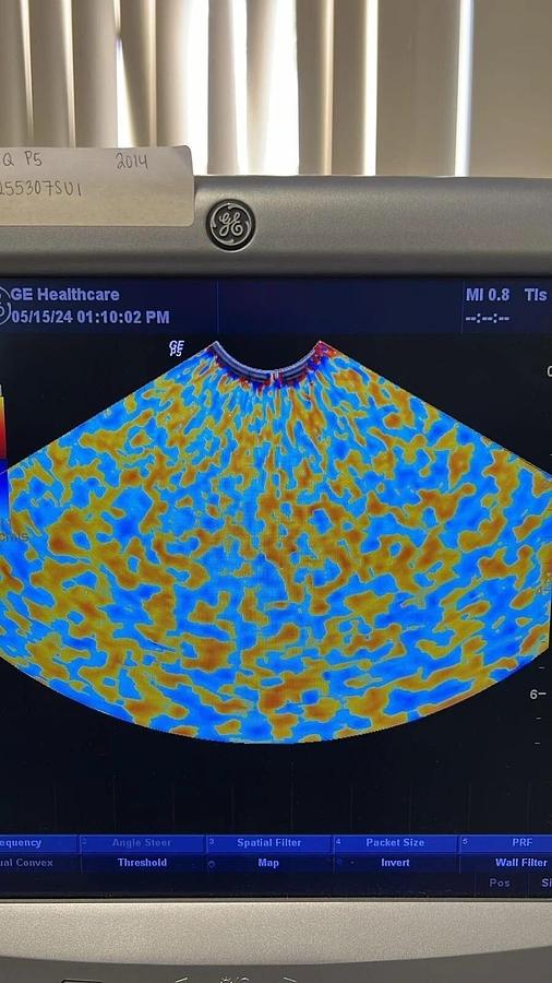 Used Zonare C5-2 Ultrasound Transducer Probe 84001 Convex Array Clear Image
