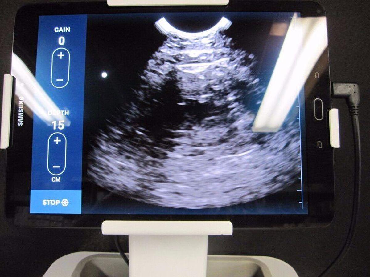 Used ECHONOUS System POCUS