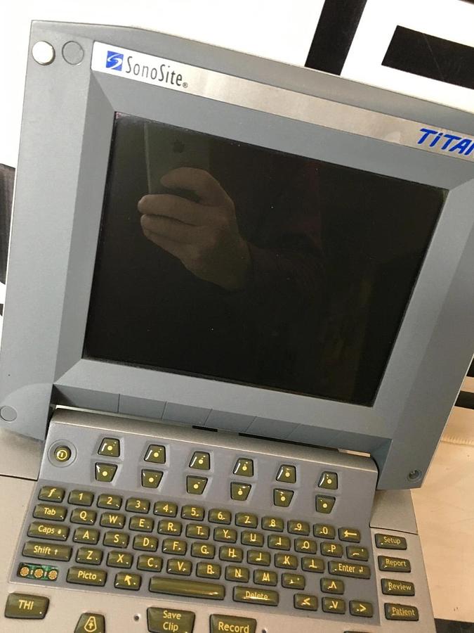 Used SonoSite Titan Ultrasound System P03073 Portable
