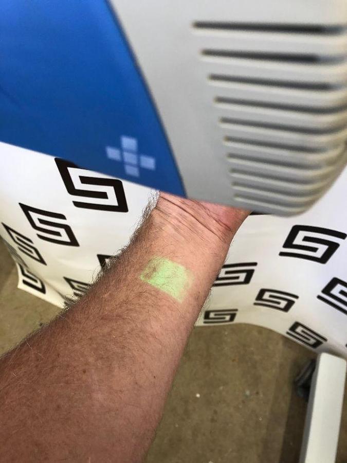 Used CHRISTIE VEINVIEWER VISION VEIN FINDER VIEWER W/ GOOD BATTERY