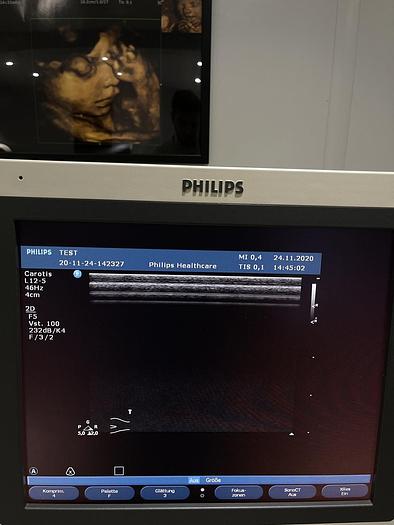 Gebraucht Philips HD 11 XE Ultraschallgerät mit 5x Sonden