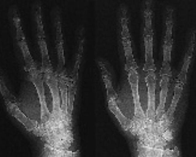 Usado 2001 General Electric (GE) Proteus Xr/a