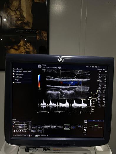 Used GE LOGIQ E9 Ultraschalgerät mit Drucker und 3 Sonden