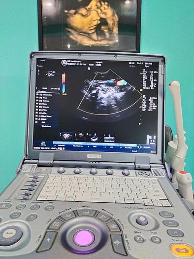 Gebraucht GE LOGIQ e tragbare Ultraschallgerät inkl. 2 Sonden und Mitsubishi P93 Drucker
