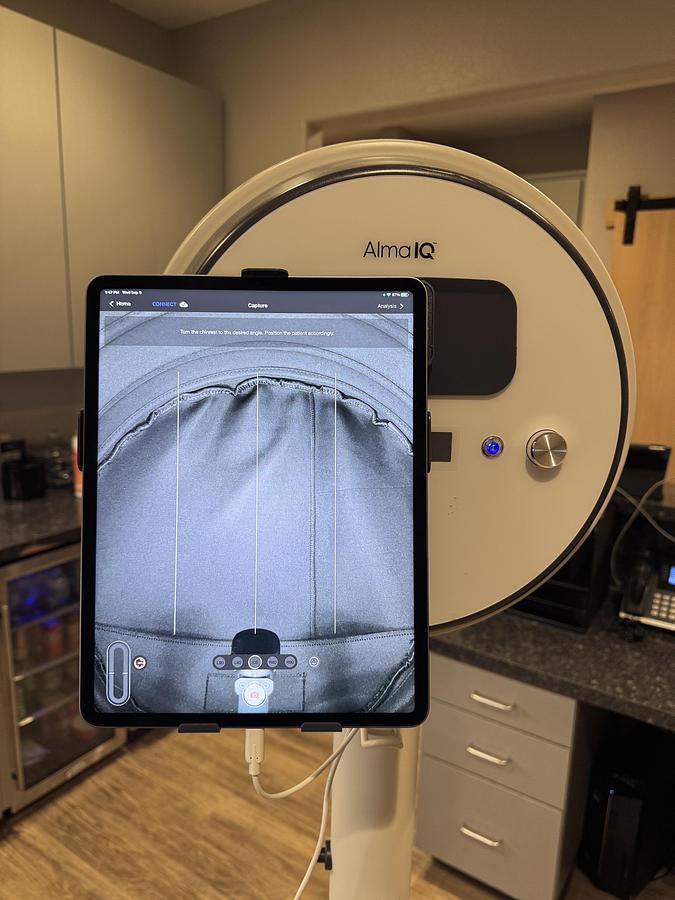 Used 2023 Alma IQ Advanced computerized skin-imaging