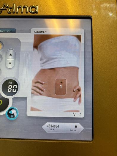 Used Alma Lasers Soprano ICE ~ 755 and 1064 Hair removal Laser ~ 2019 ~ Warranty ~