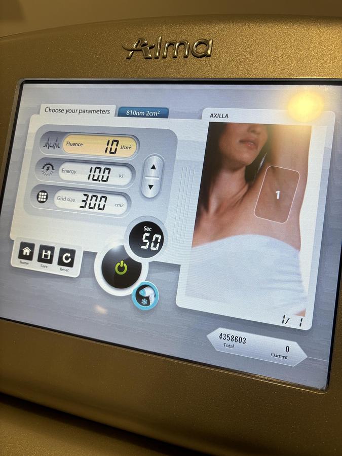 Used 2020 Alma Lasers Soprano ICE Hair removal Laser 810 nm