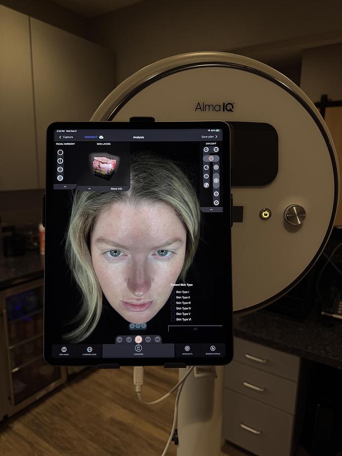Used 2023 Alma IQ Advanced computerized skin-imaging