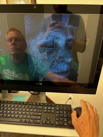 Used Canfield Visia Black RS232 ~ Very Low Use ~ Warranty ~