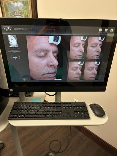 Used Canfield Visia Black RS232 ~ Very Low Use ~ Warranty ~