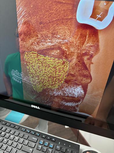 Used Canfield Visia Black RS232 ~ Very Low Use ~ Warranty ~