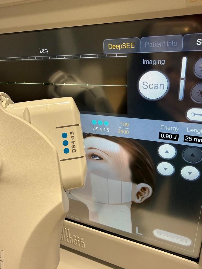 Used 2024 Ulthera Ulthera System UC-1Control Unit ~ DeepSEE w/ Transducers