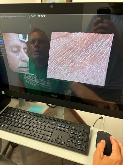 Used Canfield Visia Black RS232 ~ Very Low Use ~ Warranty ~