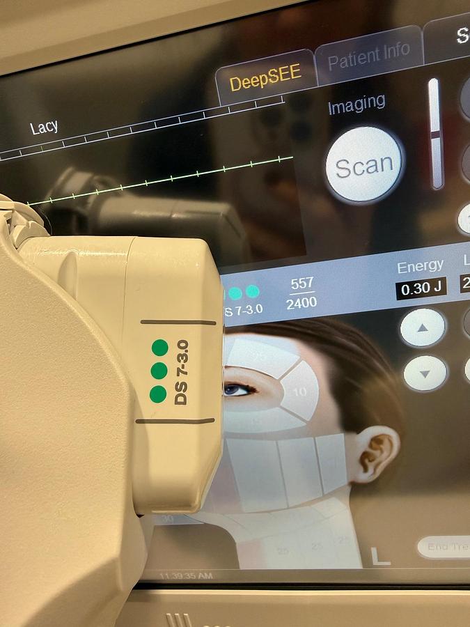 Used 2024 Ulthera Ulthera System UC-1Control Unit ~ DeepSEE w/ Transducers