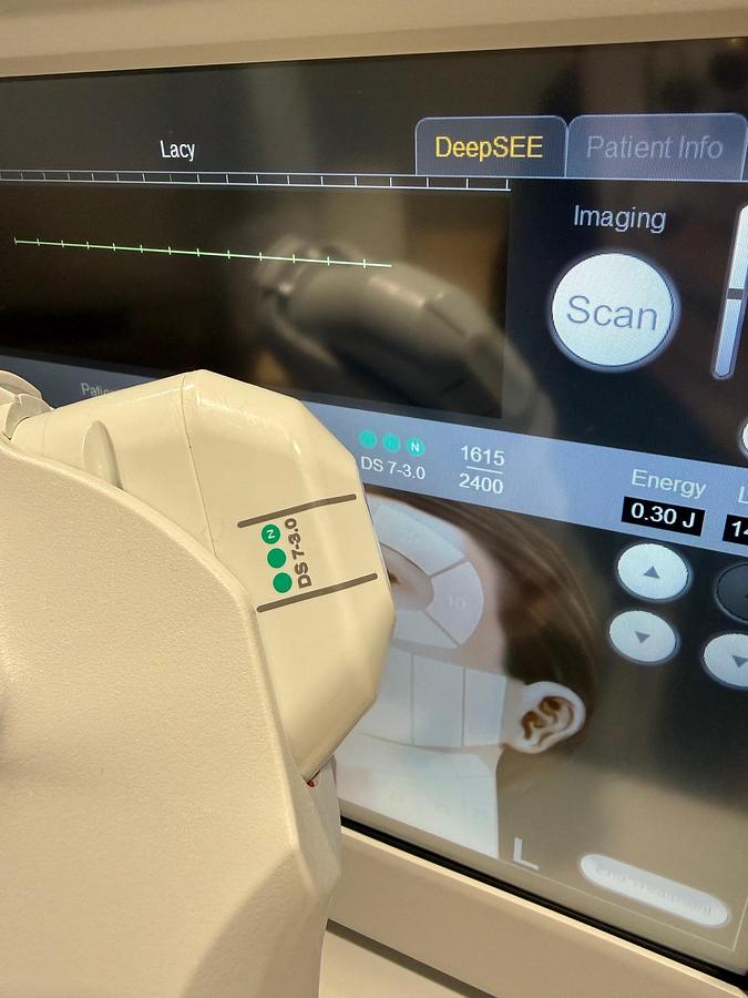 Used 2024 Ulthera Ulthera System UC-1Control Unit ~ DeepSEE w/ Transducers