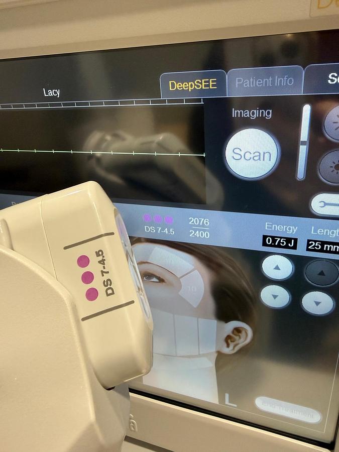 Used 2024 Ulthera Ulthera System UC-1Control Unit ~ DeepSEE w/ Transducers