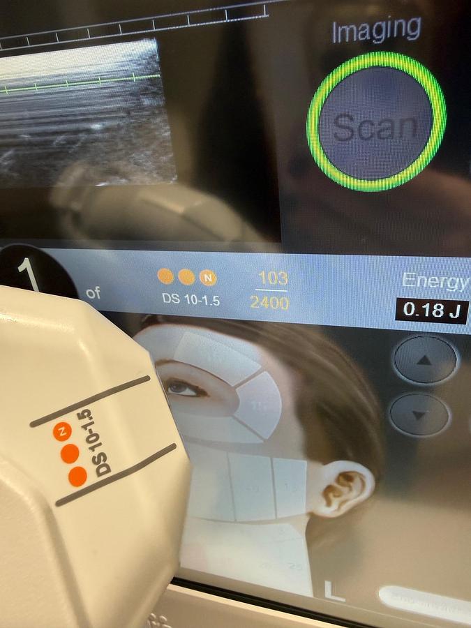 Used 2024 Ulthera Ulthera System UC-1Control Unit ~ DeepSEE w/ Transducers