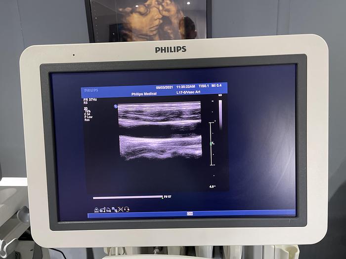 Gebraucht Philips iU22 Ultraschallgerät mit Flachmonitor, 5 Sonden, Sony Drucker, Fußschalter