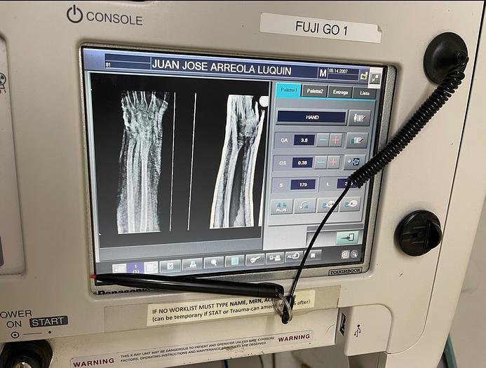 Reformado Rayos X rodable FujiFilm FCR GO