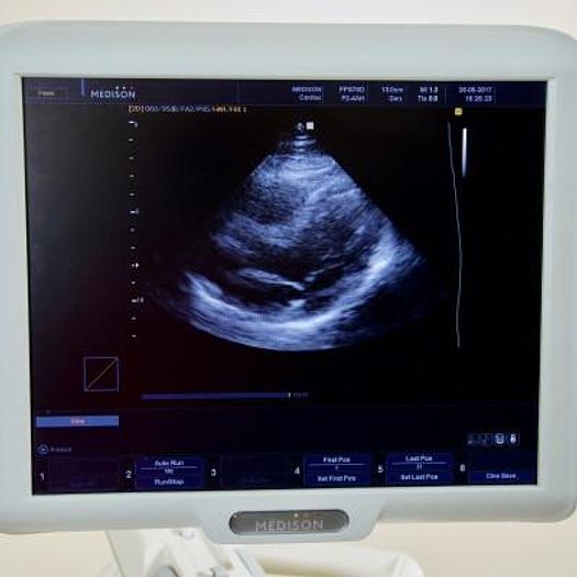 D'occasion ECHOGRAPHE  "RADIO+CARDIO"  MEDISON SONOACE X8 COULEUR DOPPLER 4 SONDES