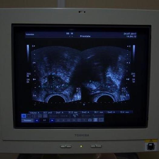 D'occasion ECHOGRAPHE TOSHIBA APLIO COULEUR DOPPLER AVEC 3 SONDES