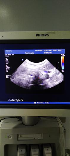 Gebraucht Philips C8-5 Microkonvex