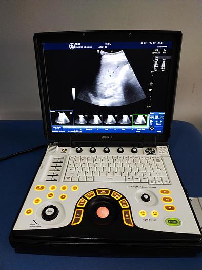 Gebraucht GE LOGIQ e tragbare Ultraschallgerät inkl. 3 Sonden und Mitsubishi P93 Drucker