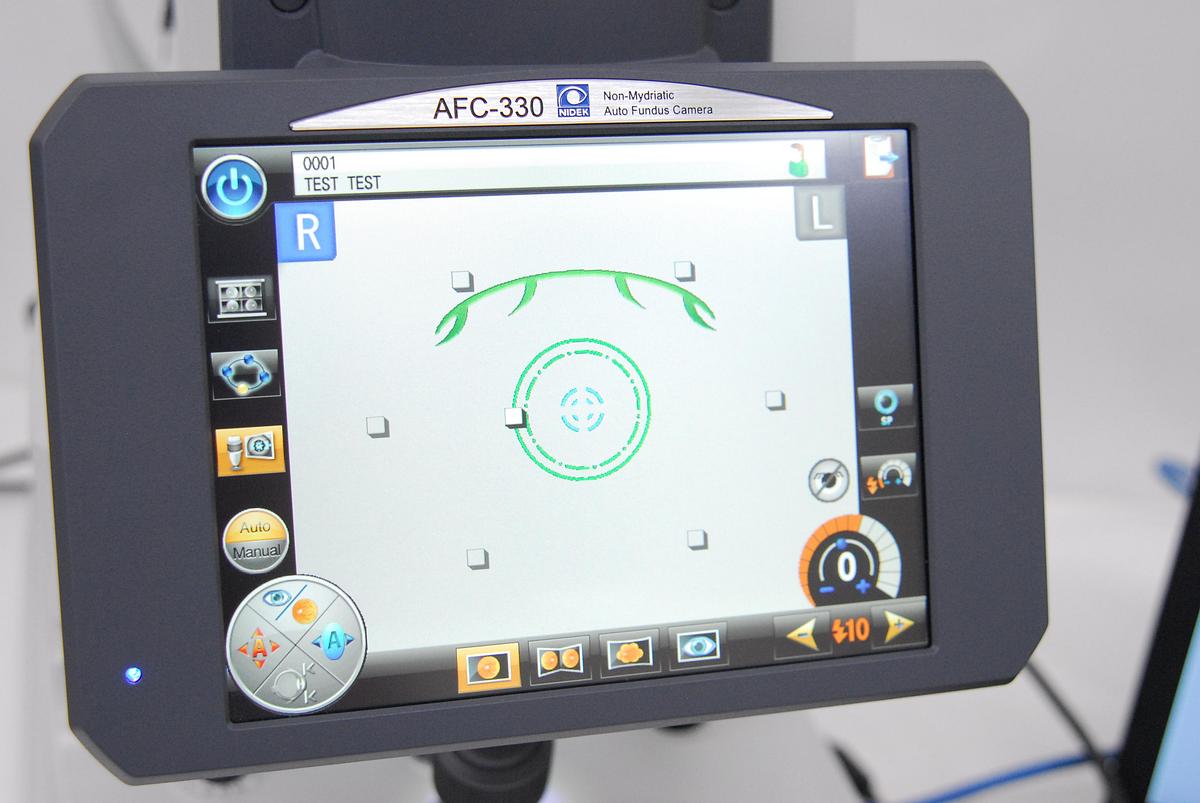 Used Nidek AFC-330 Non-Mydriatic Auto Fundus Camera W/ Case, Software, Laptop