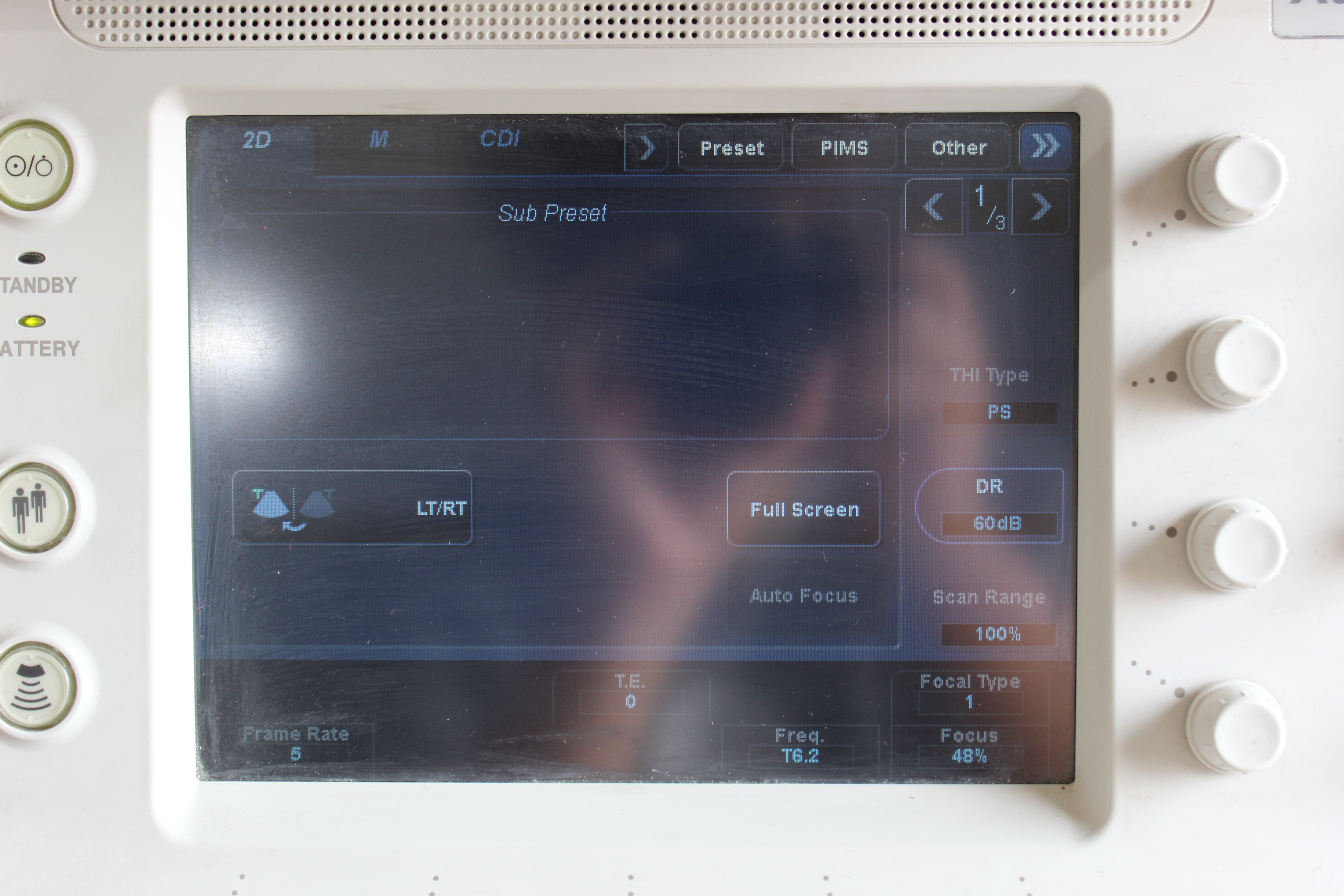 Used Toshiba Xario 200 Ultrasound TUS-X200 w/ 6S3 + 18L7 Probes