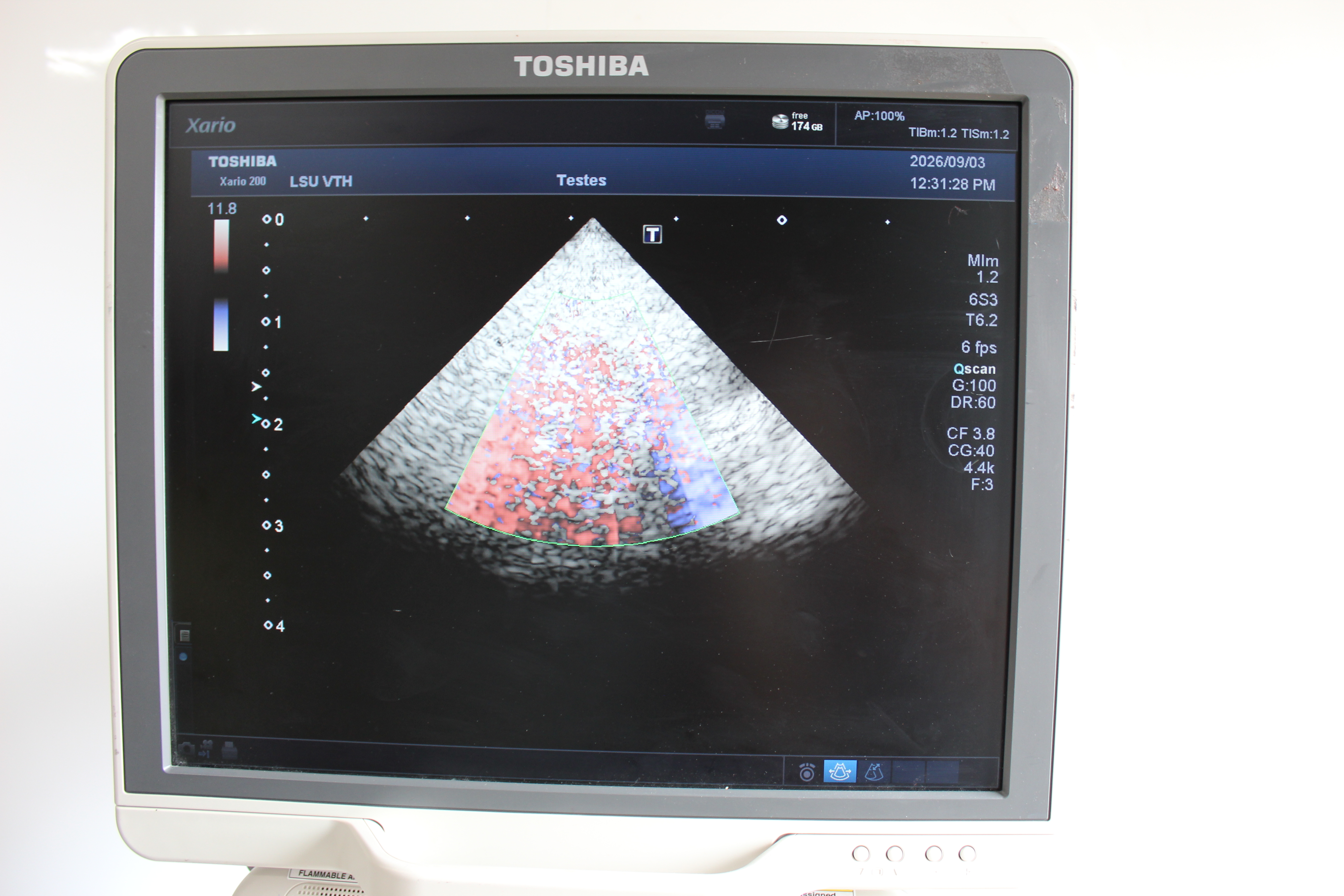 Used Toshiba Xario 200 Ultrasound TUS-X200 w/ 6S3 + 18L7 Probes
