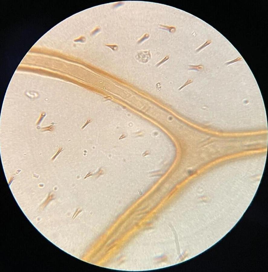 Used Leitz 63X Oel Fluoresz Objective (170/0.17 63/1.30 Oel Fluoresz)