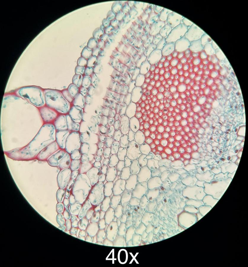 Used Motic BA300 Trinocular Phase Contrast Microscope W/ Plan 4/10/40/100 Objectives