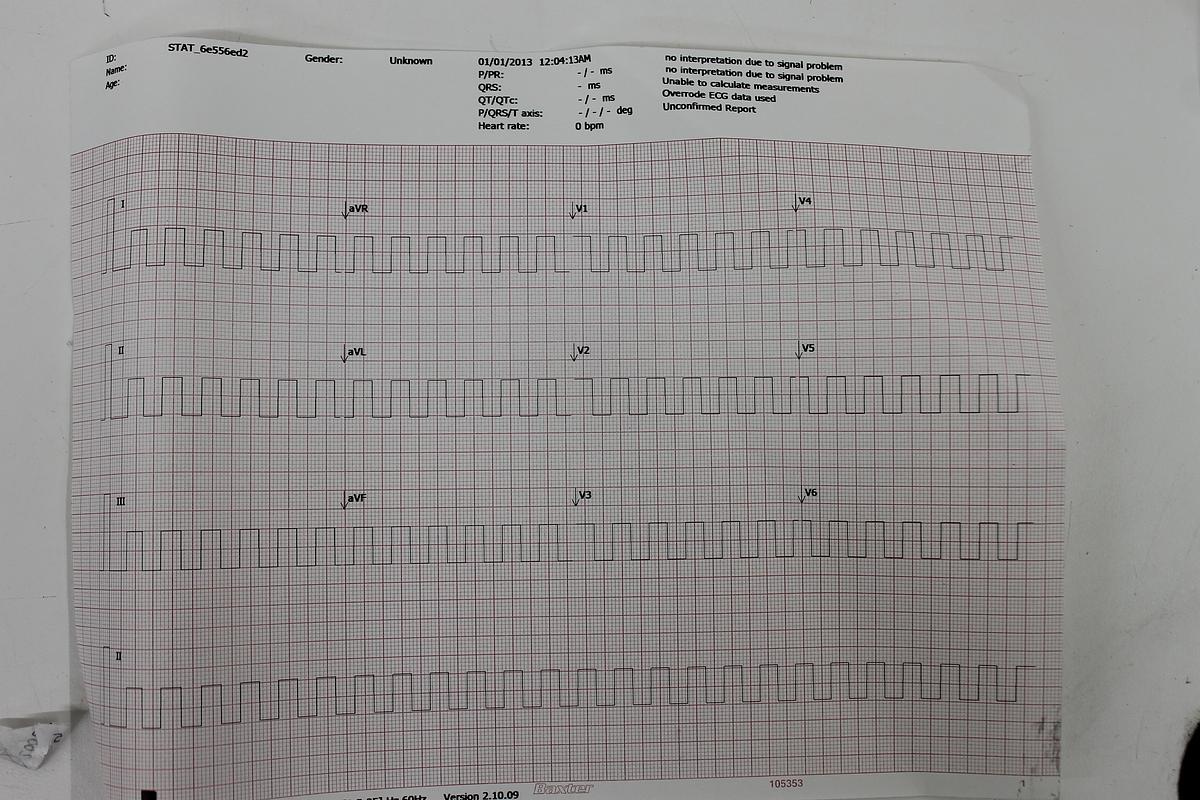 Used Welch Allyn REF 901049 Electrocardiograph EKG w/ Manual, Accessories, Leads