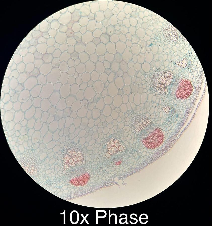 Used Motic BA400 Trinocular Phase Contrast Microscope W/ 4/10/20/40/100 Objectives