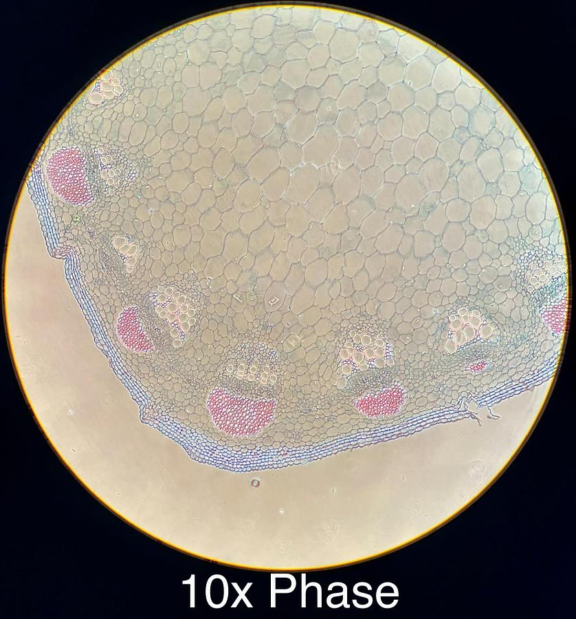 Used Motic BA400 Trinocular Phase Contrast Microscope W/ Plan 10/20/40/100 Objectives