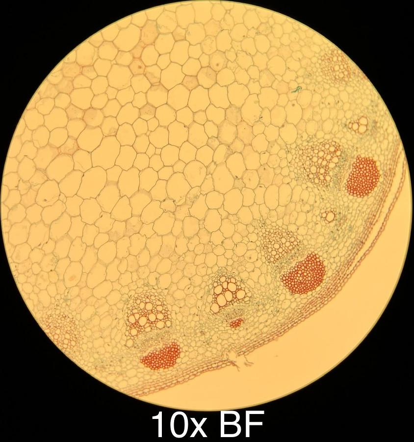 Used Motic BA400 Trinocular Phase Contrast Microscope W/ 4/10/20/40/100 Objectives