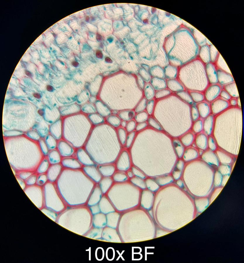Used Motic BA400 Trinocular Phase Contrast Microscope W/ Plan 10/20/40/100 Objectives