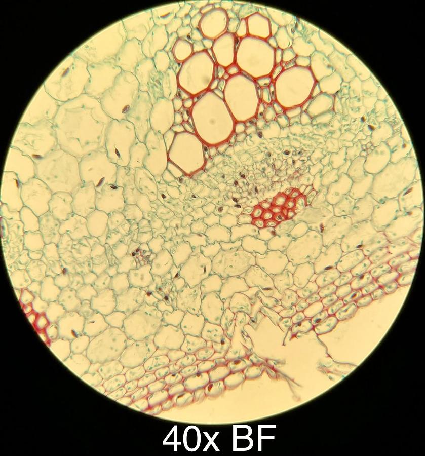 Used Motic BA400 Trinocular Phase Contrast Microscope W/ 4/10/20/40/100 Objectives