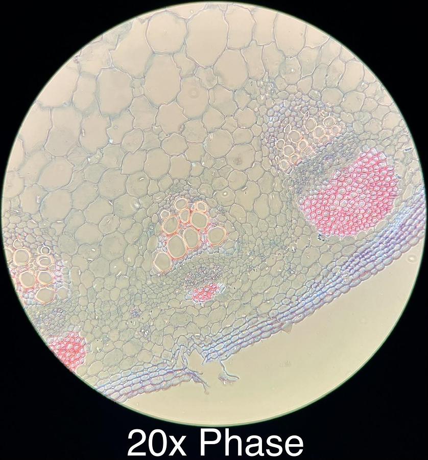 Used Motic BA400 Trinocular Phase Contrast Microscope W/ 4/10/20/40/100 Objectives
