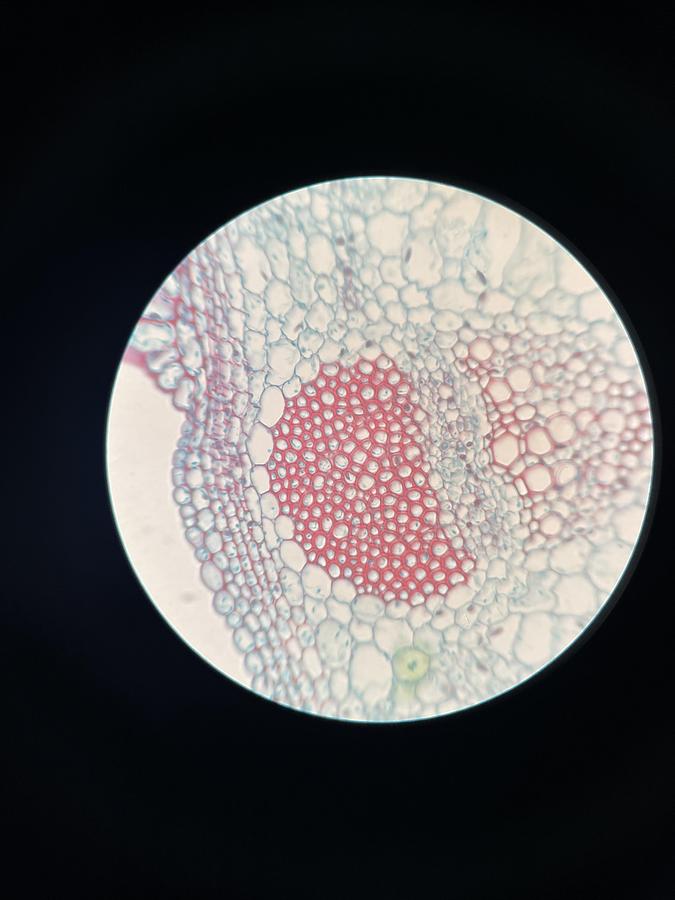 Used Olympus Plan 40x/0.65 ∞/0.17 Infinity Plan Achromatic Microscope Objective