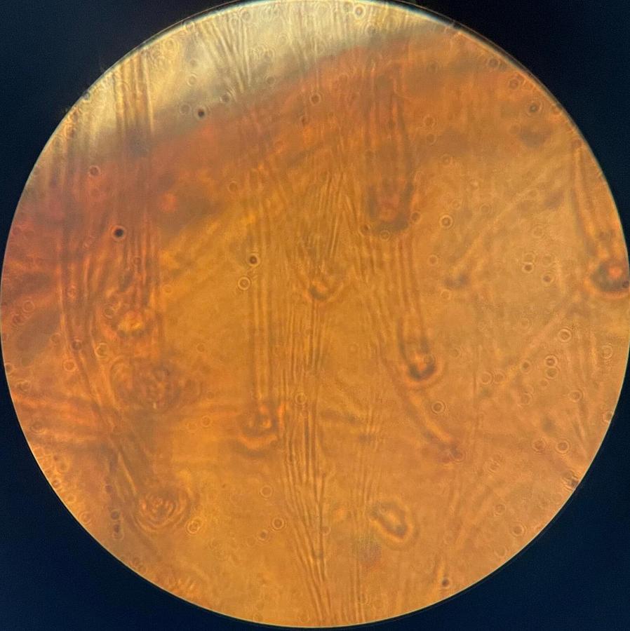 Used ASC 100/1.25 OIL 160/0.17 Objective Achromatic Super Contrast