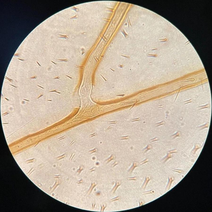 Used Olympus A 40 PL 1-LP150 Objective (A 40 PL 0.65 160/0.17)